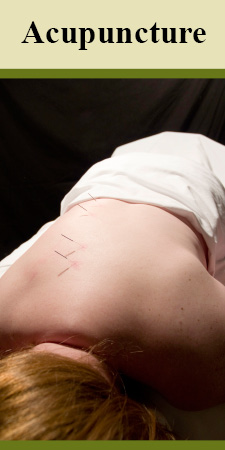 Acupuncture